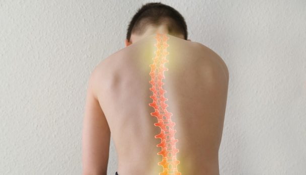 Scoliosis treatments