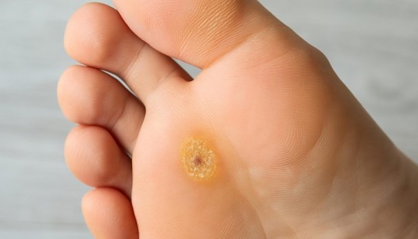 shutterstock_2611506261